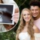 Patrick Mahomes and Brittany Mahomes pregnancy